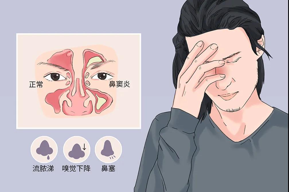 成都看鼻窦炎医院