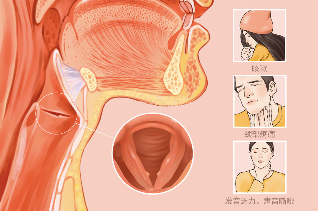 声带小结怎么预防?成都仁品耳鼻喉医院